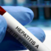 Tras 4 días del brote de Hepatitis A siguen sin localizar foco de infección