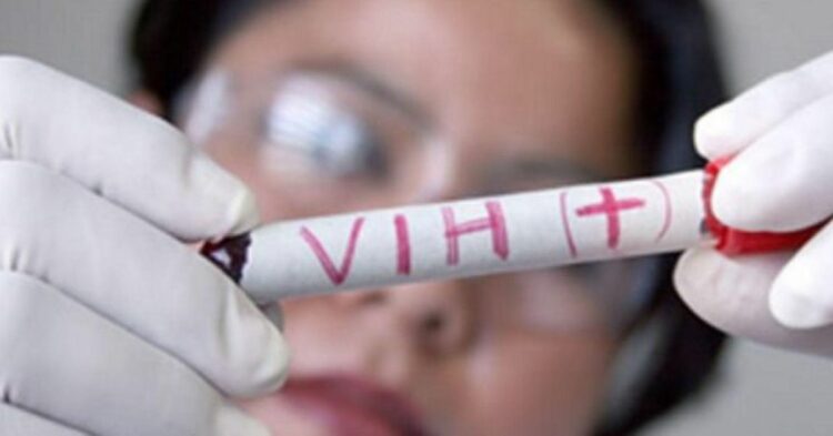 Alertan por incremento de casos de VIH en Tampico. Foto de web